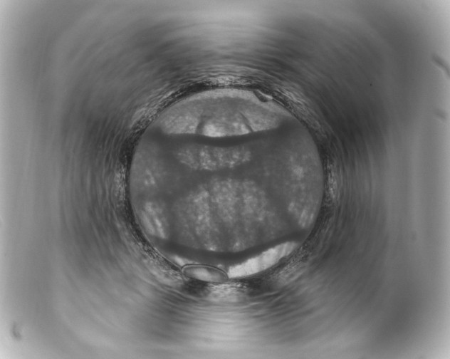 X0000099380461200805291132