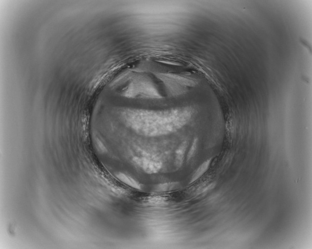 X0000099380462200805291132