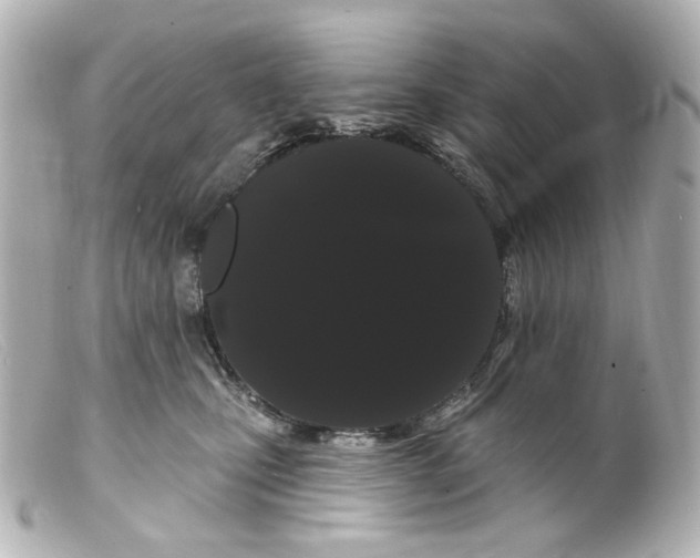 X0000099380471200805291132