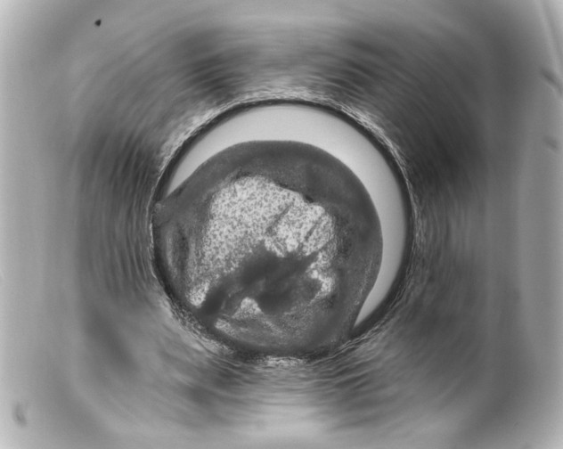 X0000099380487200805291131