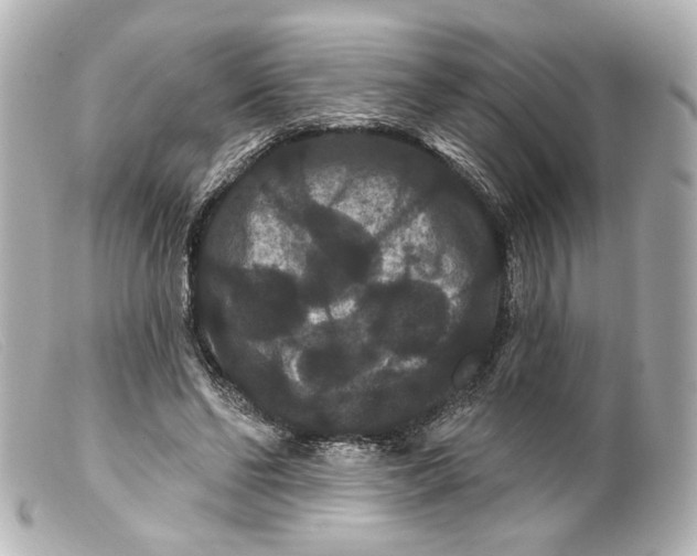 X0000099380494200805291131