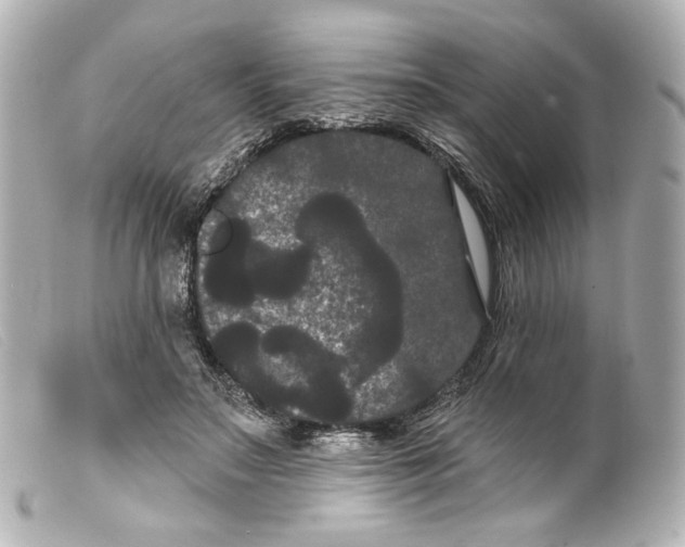 X0000099380499200805291131