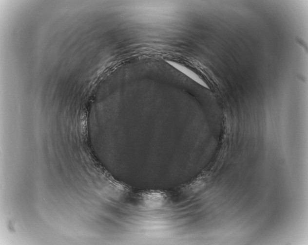 X0000099380513200805291131