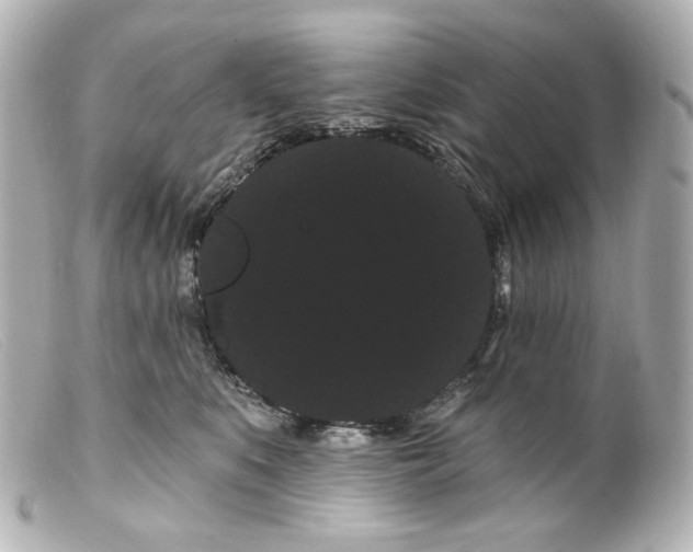 X0000099380519200805291131