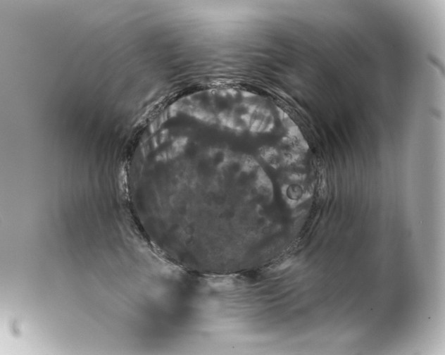 X0000099380523200805291131