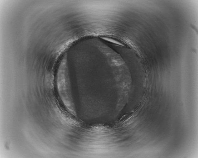 X0000099380540200805291130