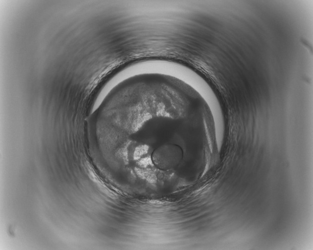 X0000099380542200805291130