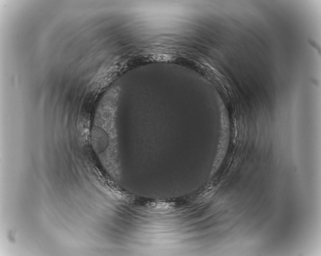 X0000099380553200805291131