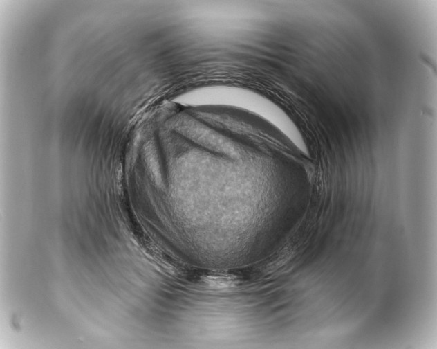 X0000099380556200805291131