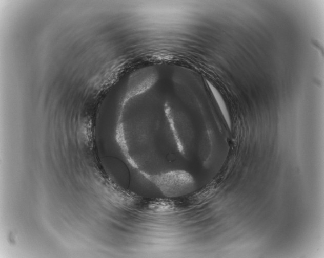 X0000099380559200805291131