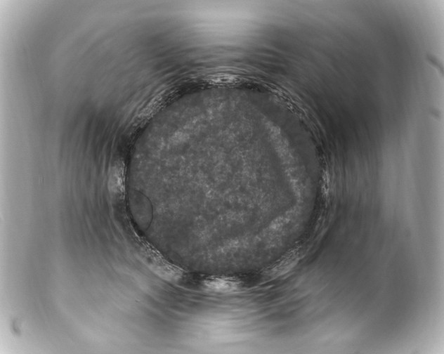 X0000099380561200805291131