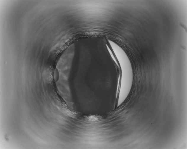 X0000099380566200805291131