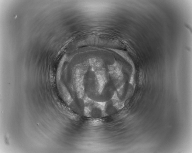 X0000099380569200805291131