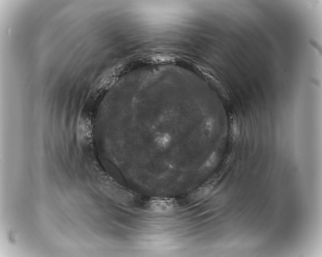 X0000099380571200805291131