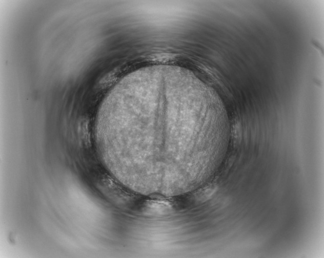 X0000099380572200805291131