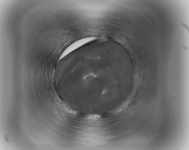 X0000099380576200805291131