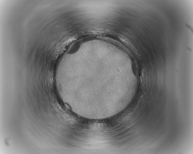 X0000099380593200805291130