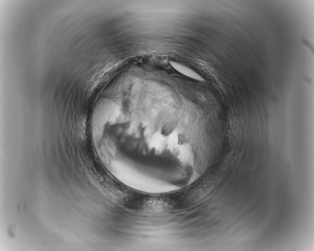 X0000099380596200805291130