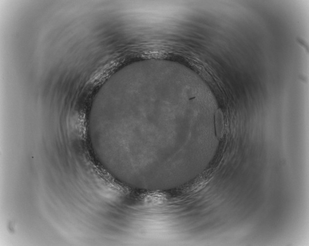 X0000099380599200805291130