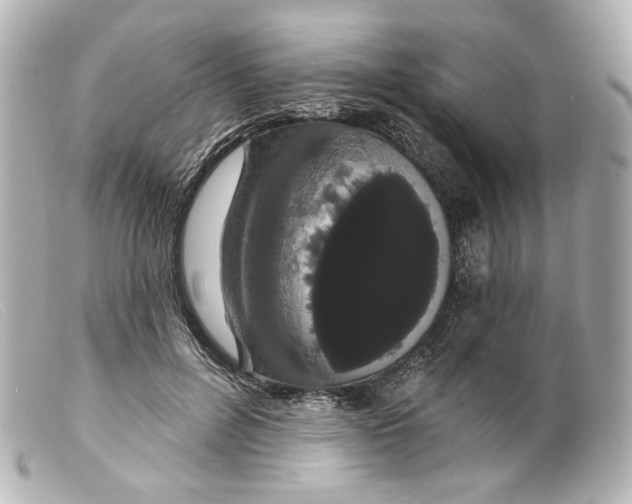 X0000099380600200805291130