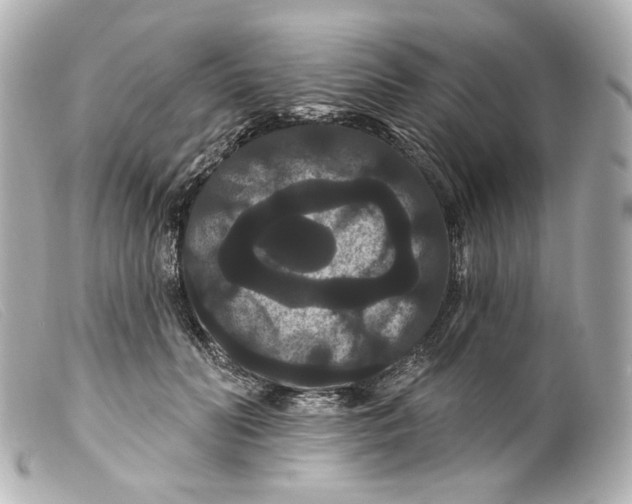 X0000099380606200805291130