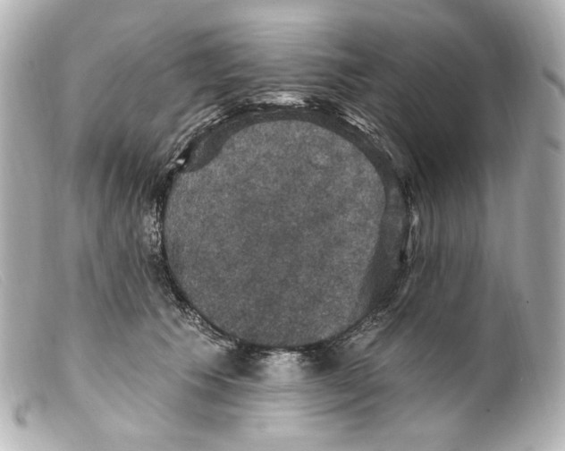 X0000099380609200805291130