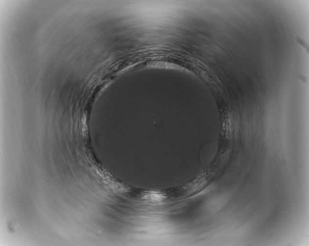 X0000099380610200805291130