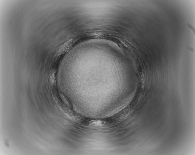 X0000099380611200805291130