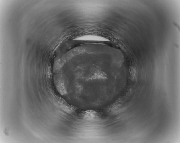 X0000099380612200805291130