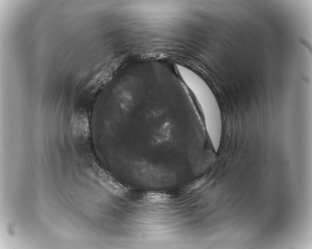 X0000099380617200805291130