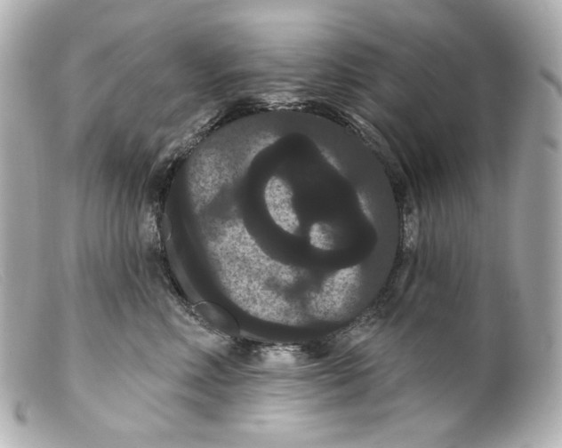 X0000099380618200805291129