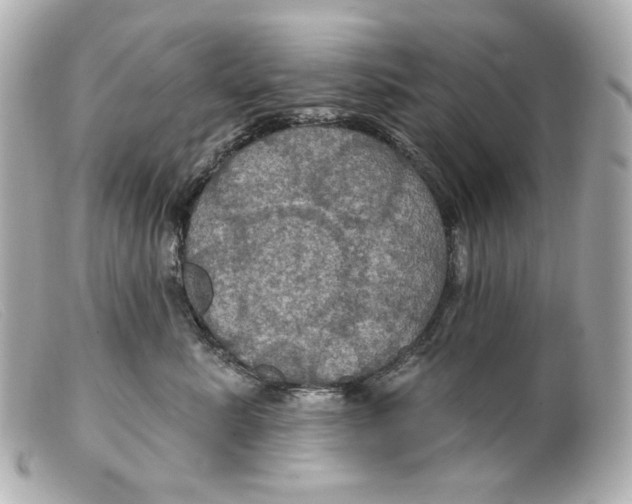 X0000099380619200805291129