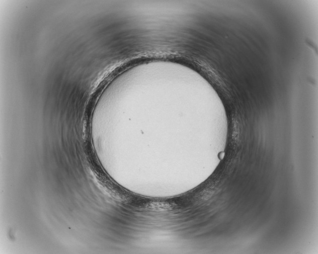 X0000099380636200805291129