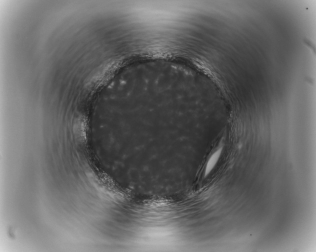 X0000099380643200805291129