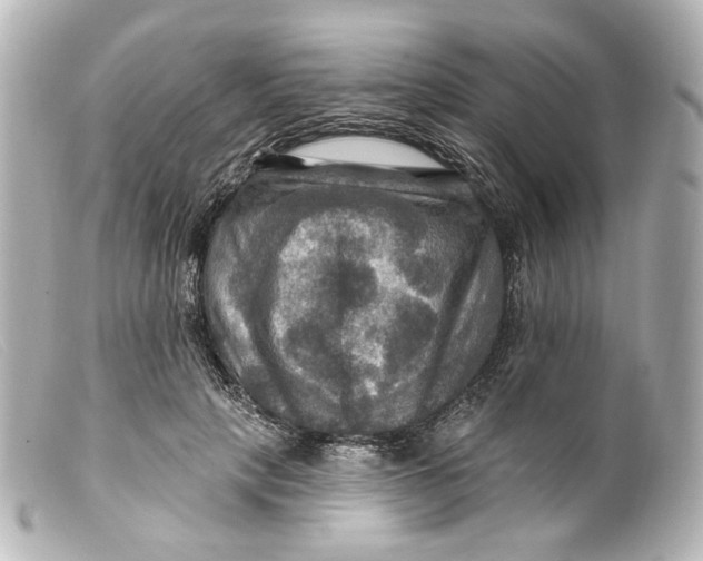 X0000099380649200805291129