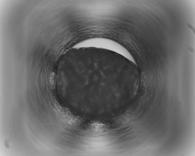 X0000099380650200805291129