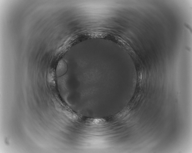 X0000099380663200805291129