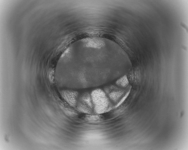 X0000099380671200805291129