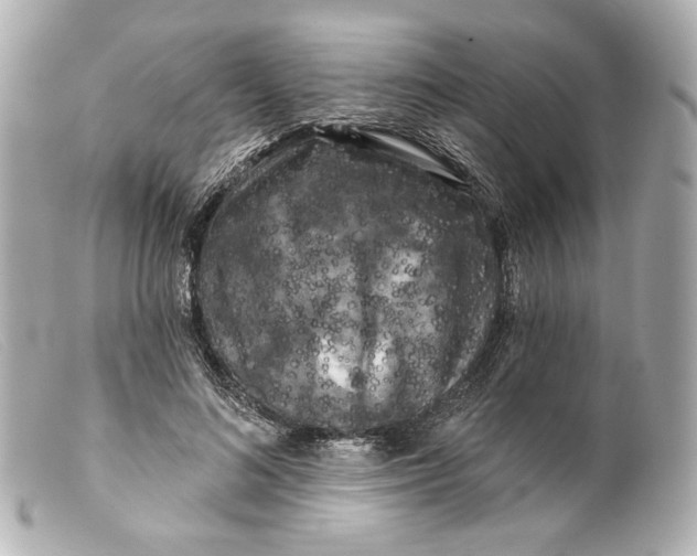 X0000099380692200805291128