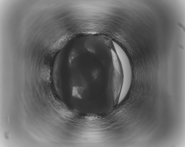 X0000099380693200805291128