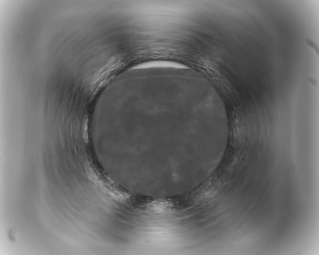 X0000099380696200805291128