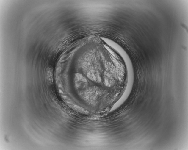 X0000099380699200805291128