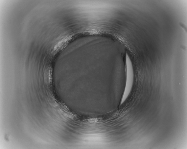 X0000099380740200805291128