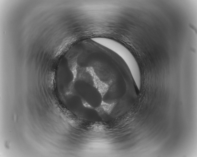 X0000099380742200805291128