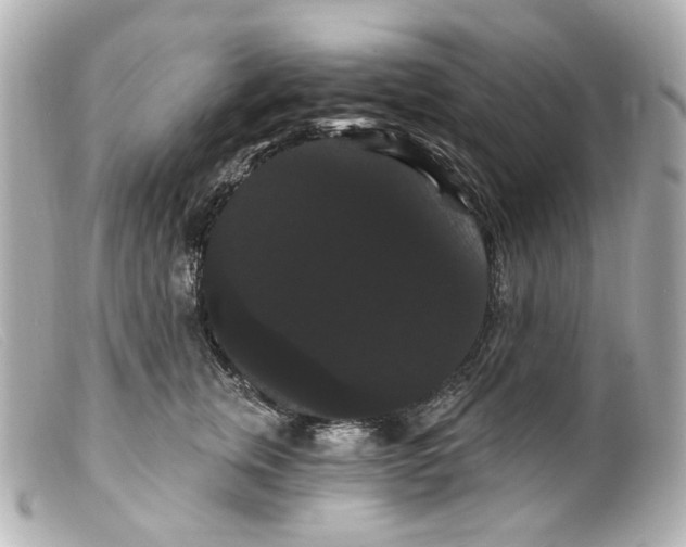 X0000099380759200805291128