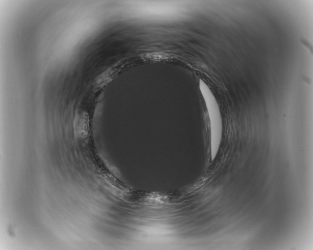 X0000099380760200805291128