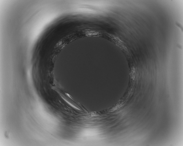 X0000099380763200805291128