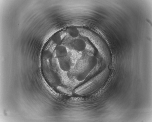 X0000099380795200805291127