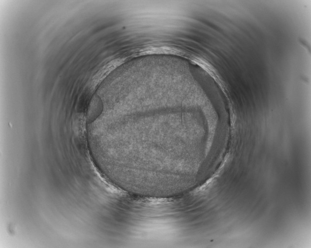 X0000099380849200805291127