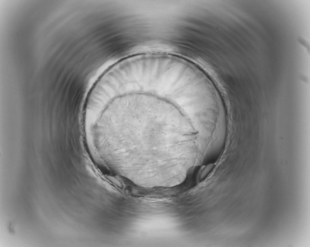 X0000099380864200805291127